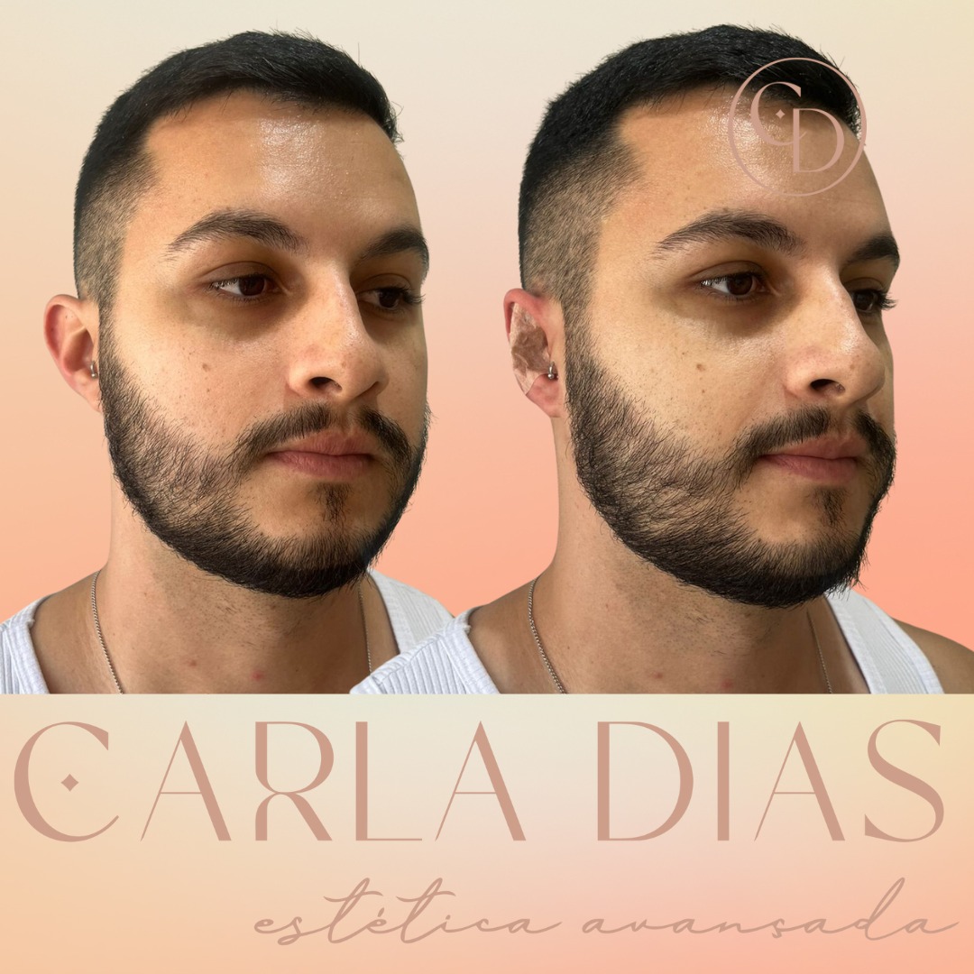 Resultado 2