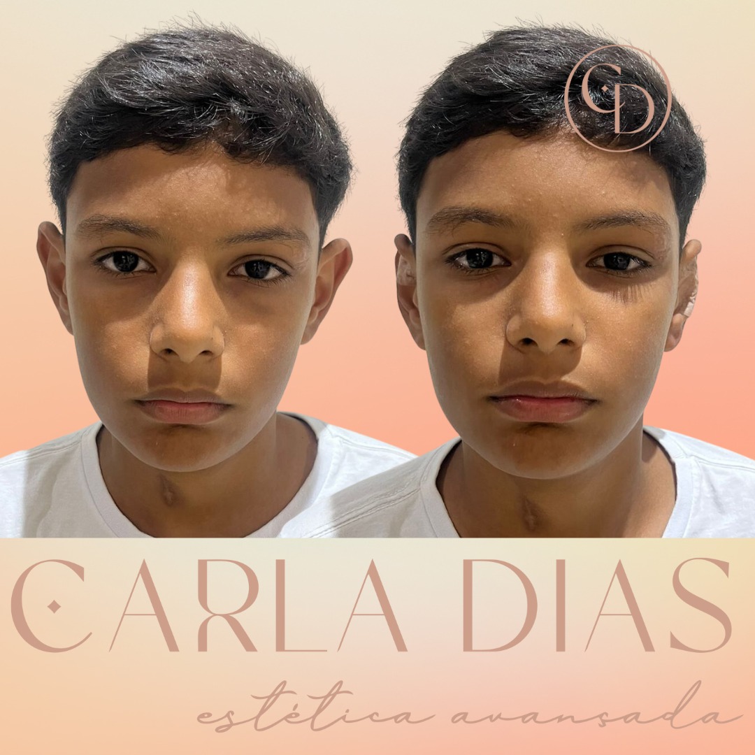 Resultado 3