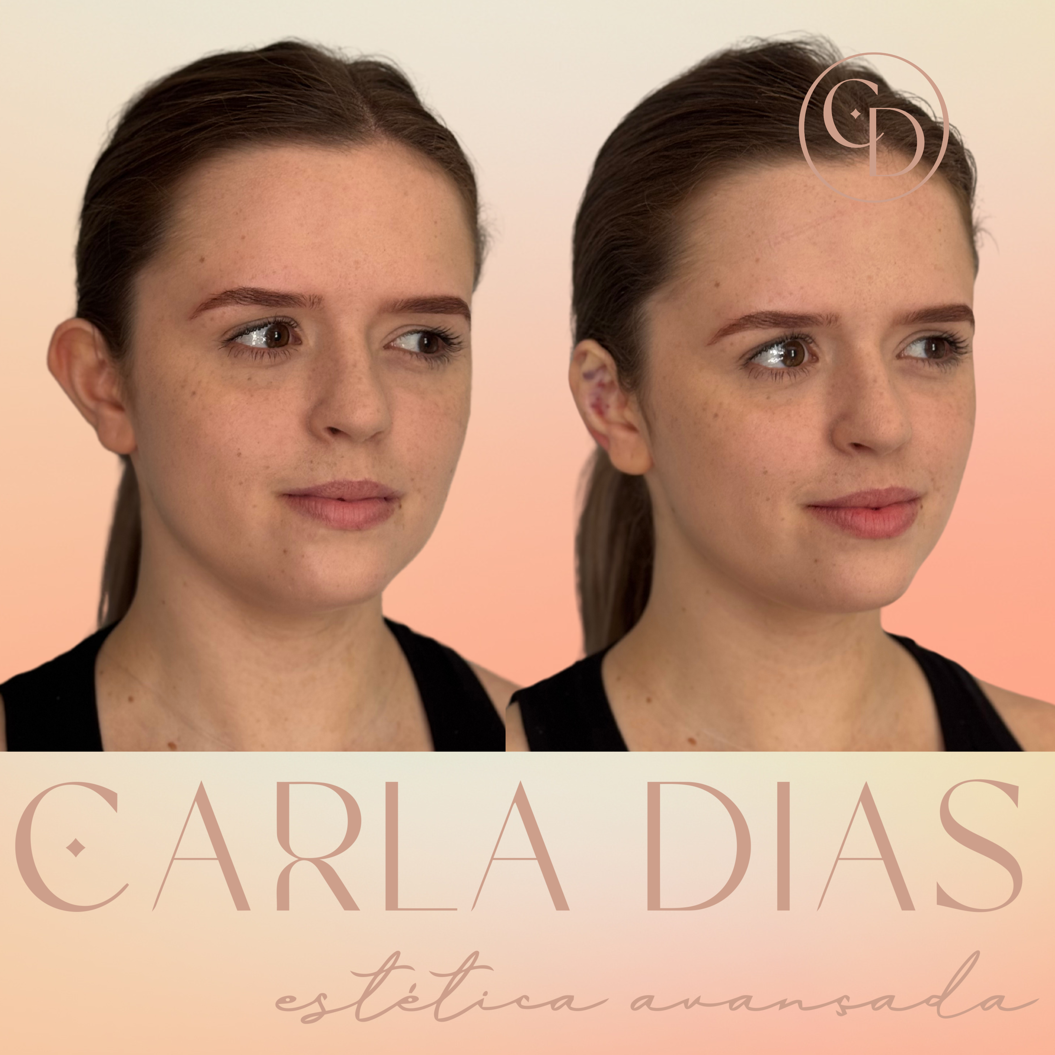 Resultado 8